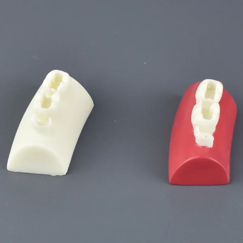 

Dental Inlay Motion Model Conodont Model Filling Resin Block Red and White Model Teaching Demonstration Tool