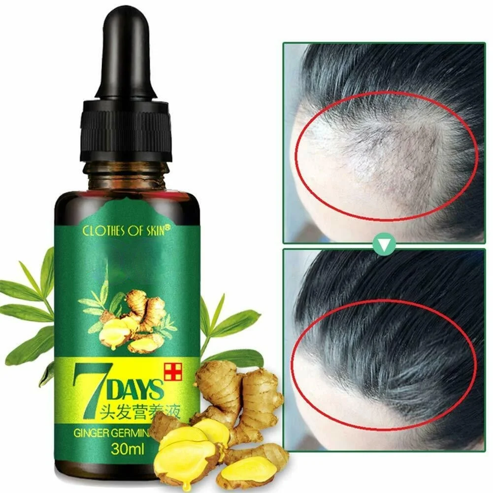 3pcs Hair Regrow 7 Day Ginger Germinal Serum Essence Oil Hair Loss Treatment Growth Effective Fast Growth Hair Care