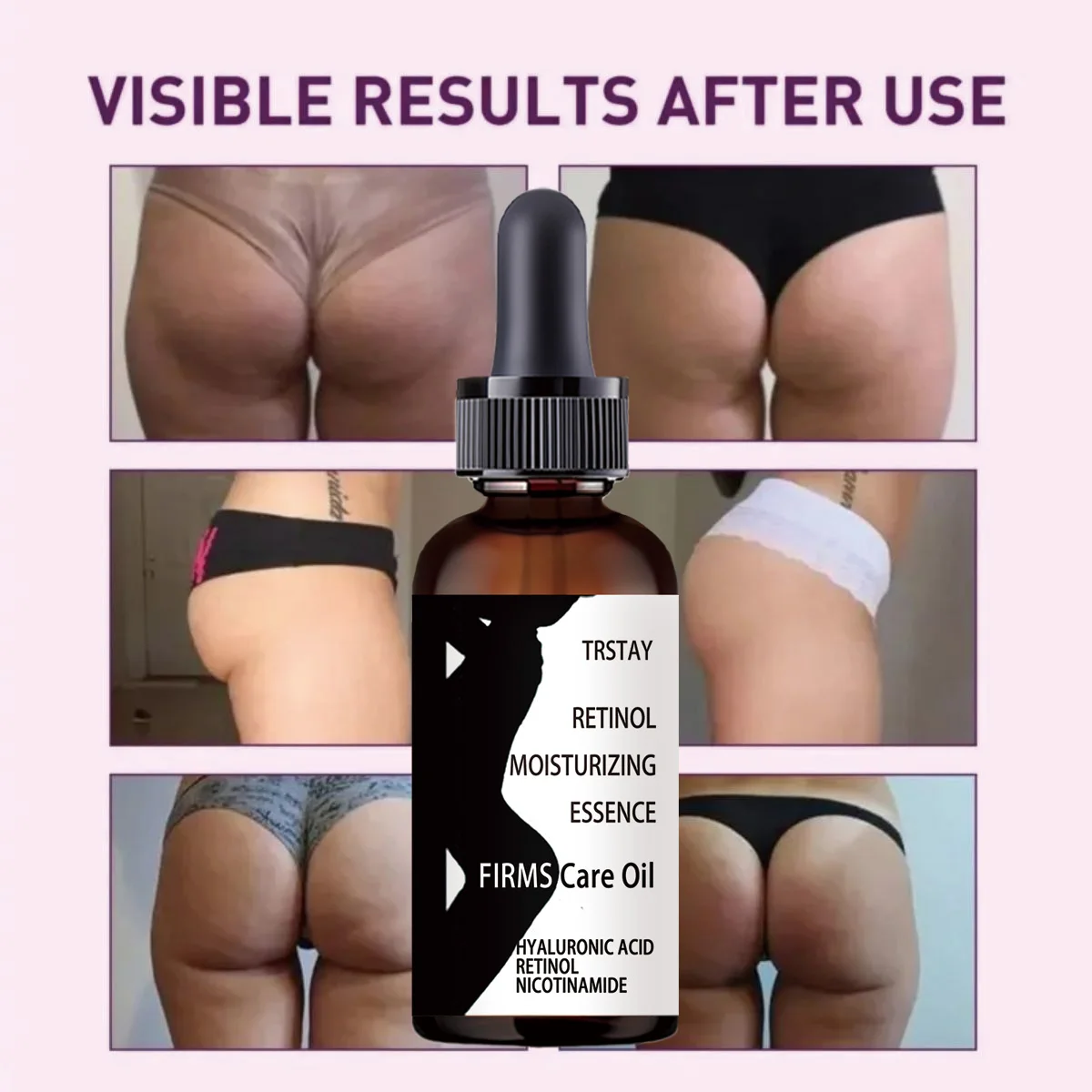Trstay-زيت الأرداف والأرداف ، زيت العناية