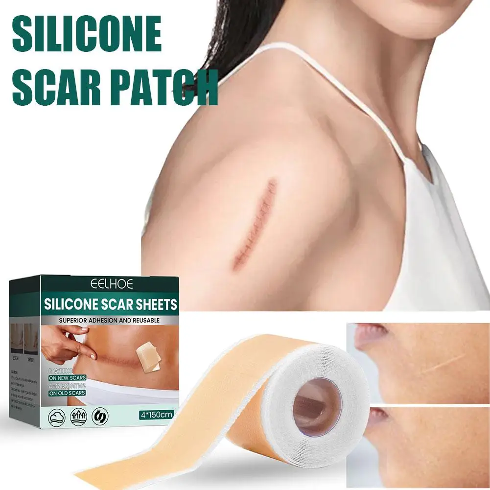 1 rotolo di fogli di cicatrici in Silicone per la riparazione della pelle rimozione della toppa per la rimozione del nastro adesivo per smagliature Patch per terapia brucia la cura della pelle della cicatrice dell'acne