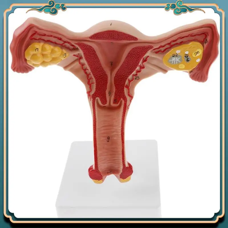 ABJG-2X 1:1 Human Female Uterus Ovary Fallopian Tubes Model Anatomical Human Anatomy Model Teaching Tools
