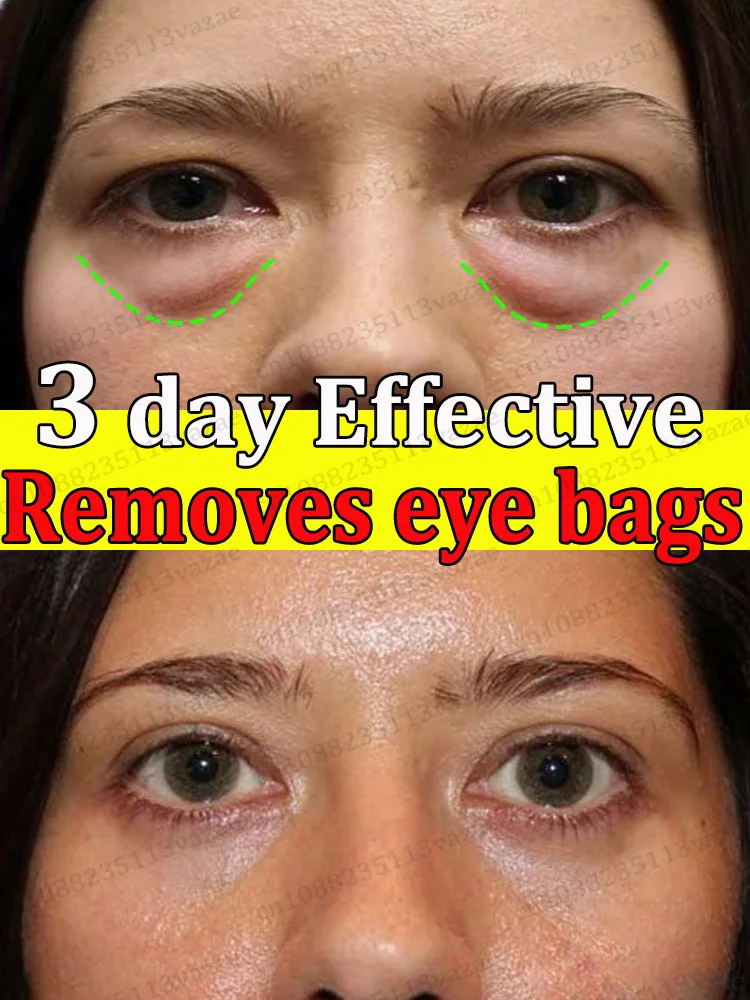 

Сделай вас выглядит младшим