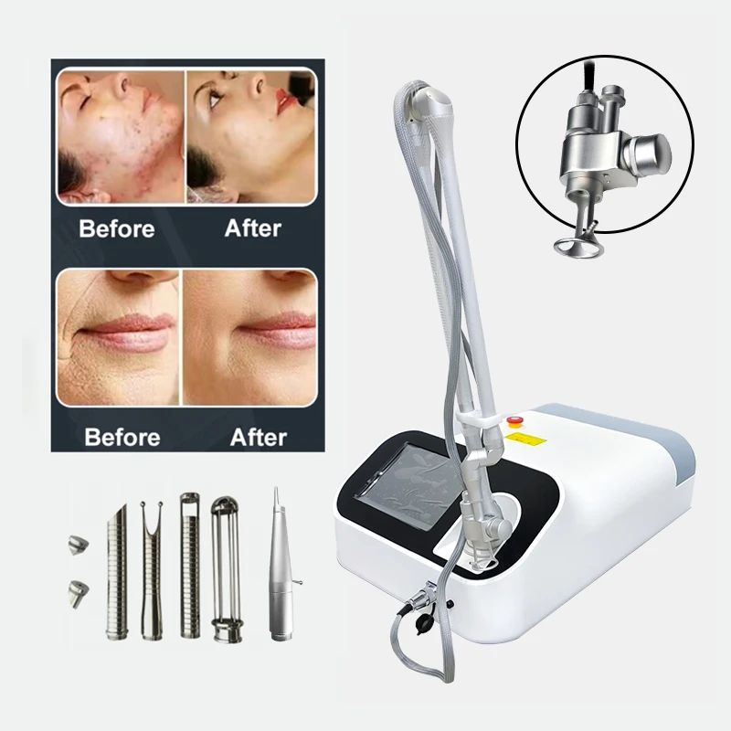 Gold Seller CO2 Fractional Machine Fraccionado Co2 Professional Wrinkle / Scar  Carbon Peeling Portabl