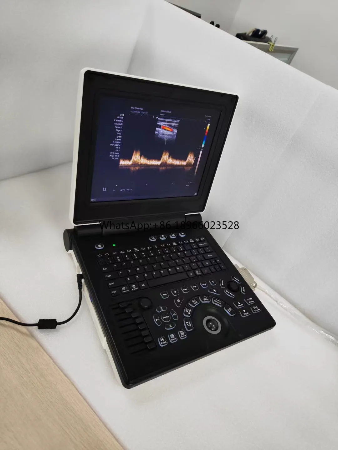 SY-AV20 vet Sunnymed Veterinary Color Doppler Machine  Precision Imaging for Veterinary Care Top-rated Perfect for Pet Hospitals