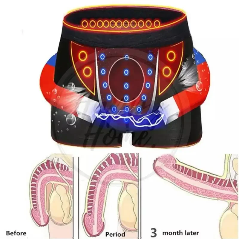 Boxer fisiologico da uomo Intimo magnetico Funzione sanitaria Pantaloncini per terapia magnetica traspirante in rete Boxer da uomo Pantaloncini energetici