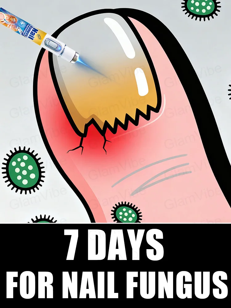 

2025 New Upgraded Version of Blue Laser Nail Fungus Treatment Tool