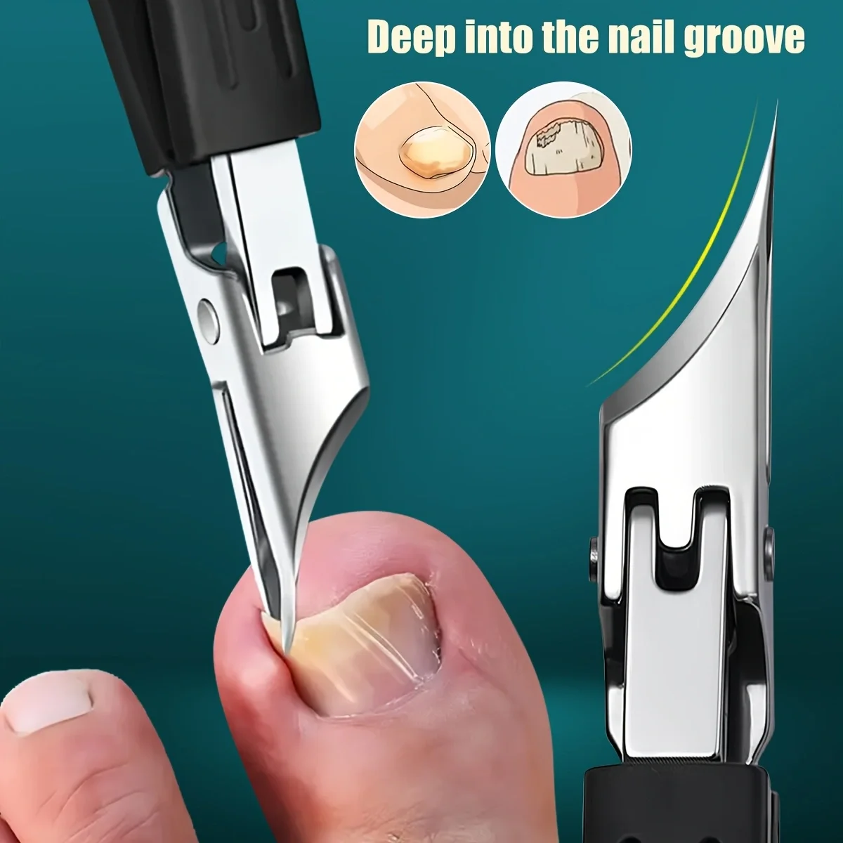 5Pcs Stainless Steel Ingrown Toenail Clippers Set for Thick Hard Nails Nail File Lifter Non-Slip Sharp Pedicure Manicure Tools