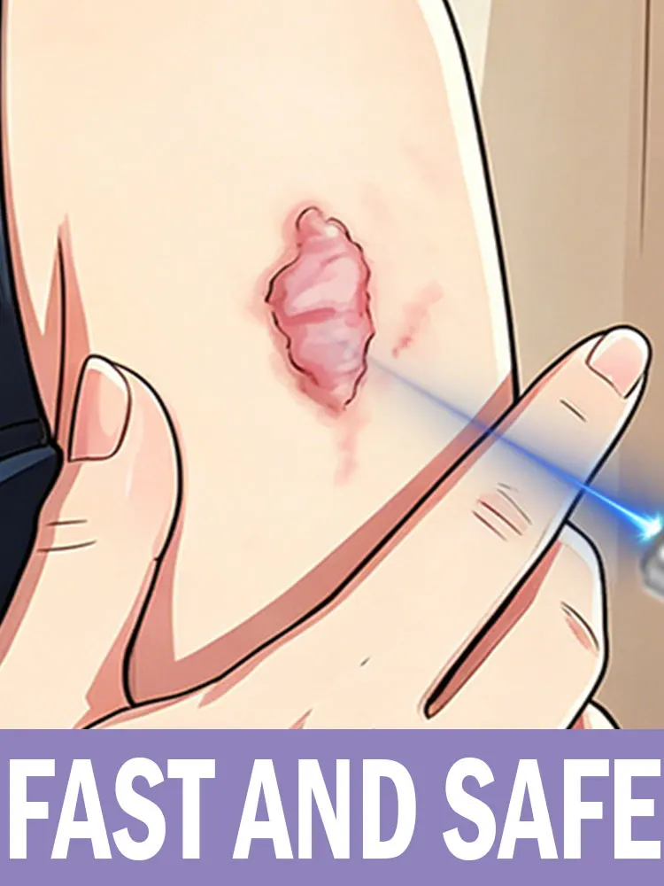Hot sale Blue light laser Diminish Scar solve your problem