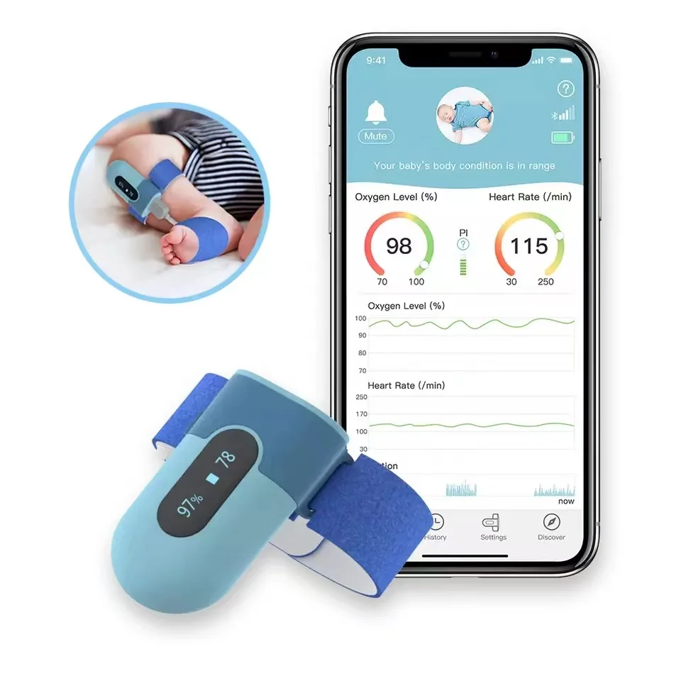 Babyo2 S2 oksimeter bayi cerdas, Monitor oksigen darah bayi Bluetooth dapat diisi ulang Spo2, pemantau denyut jantung tidur