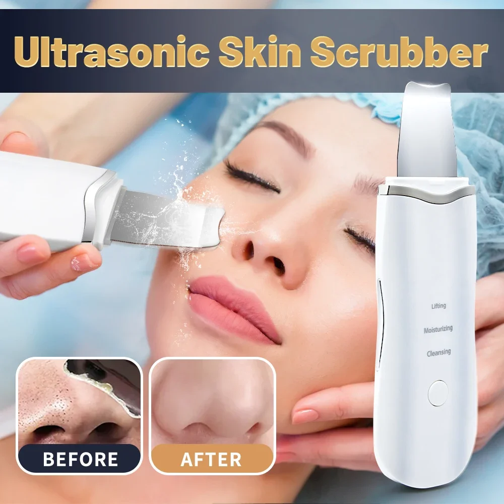 Professionale senza ultrasuoni per la pelle del viso Scrubber Ion Pulizia profonda del viso Peeling Dispositivo ricaricabile per la cura della pelle Strumento di bellezza