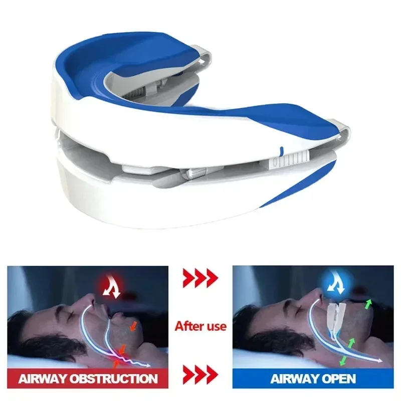 Adjustable Anti-Snoring Mouthpiece Nighttime Teeth Guard Sleeping Mouthguard for Bruxism Stop Snoring Device Assisted Sleep ﻿