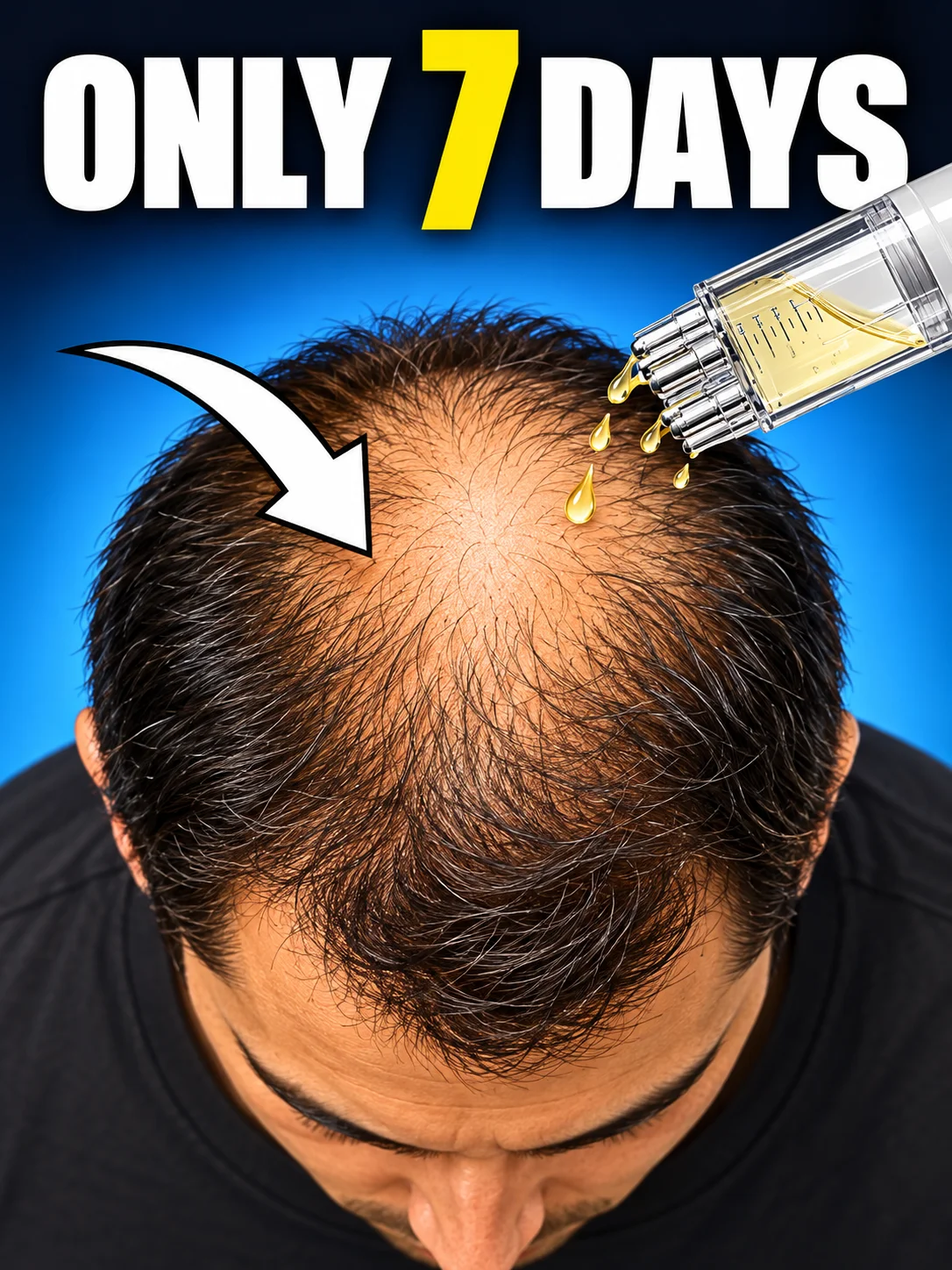 Wide Hair Part Savior, Free Shipping, Boost Fuller Hair Look, End Scalp Show Embarrassment, Hot Sale