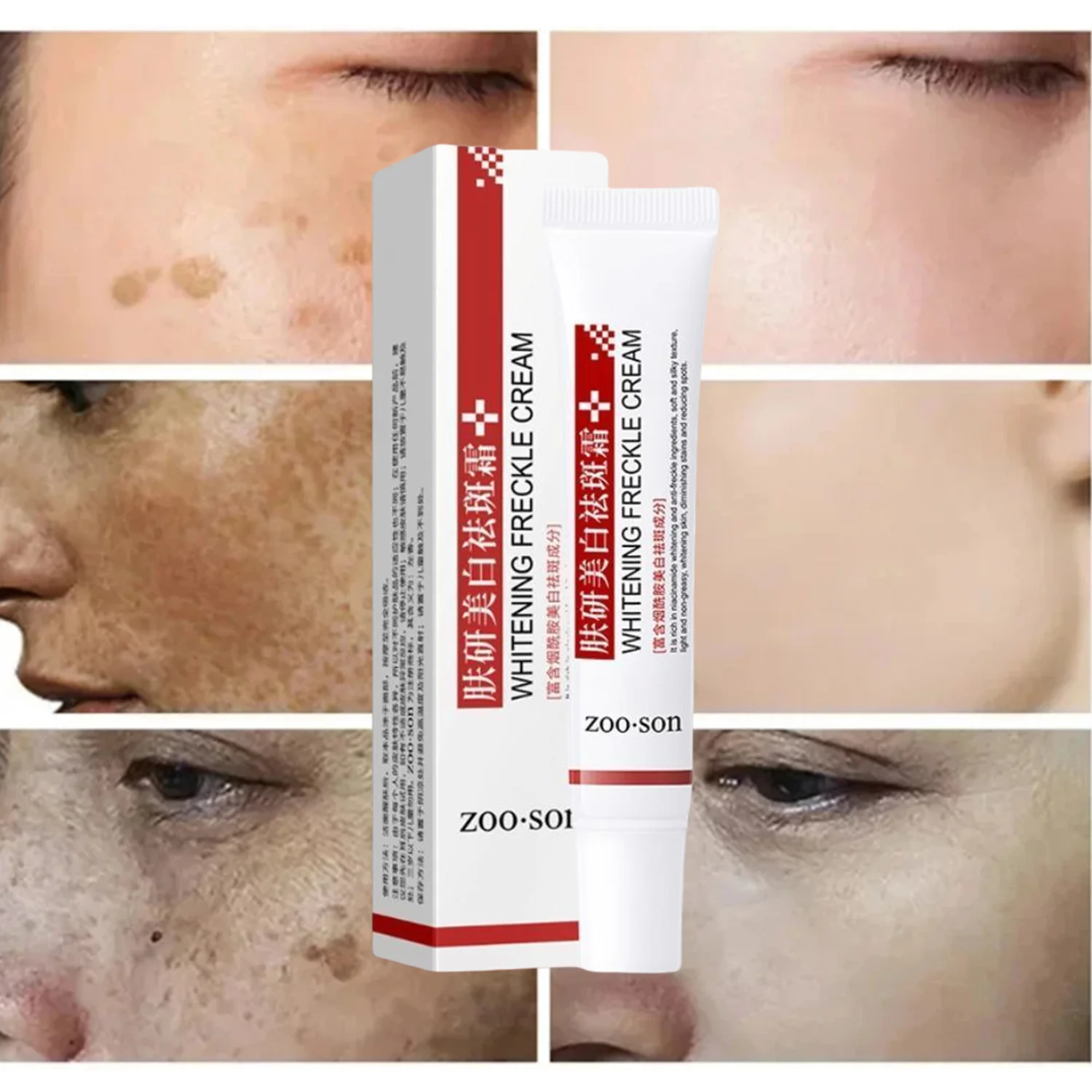 20g Whitening Freckle Cream ลบ Dark Spot Cream Anti Freckle และ Aging ครีมจางลงสีฝ้ากระจ่างใสเซรั่มผิว