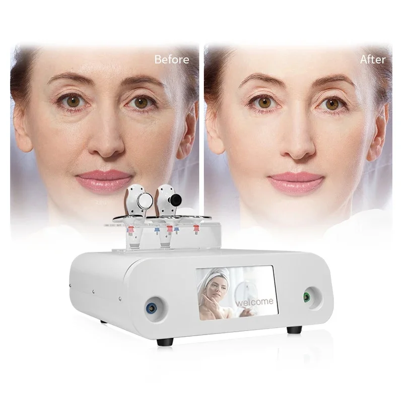 Facial 448khz Face Lifting Machine Deep Care Portable Vaginal Radiofrecuency White Indiba Health Aad Body Care