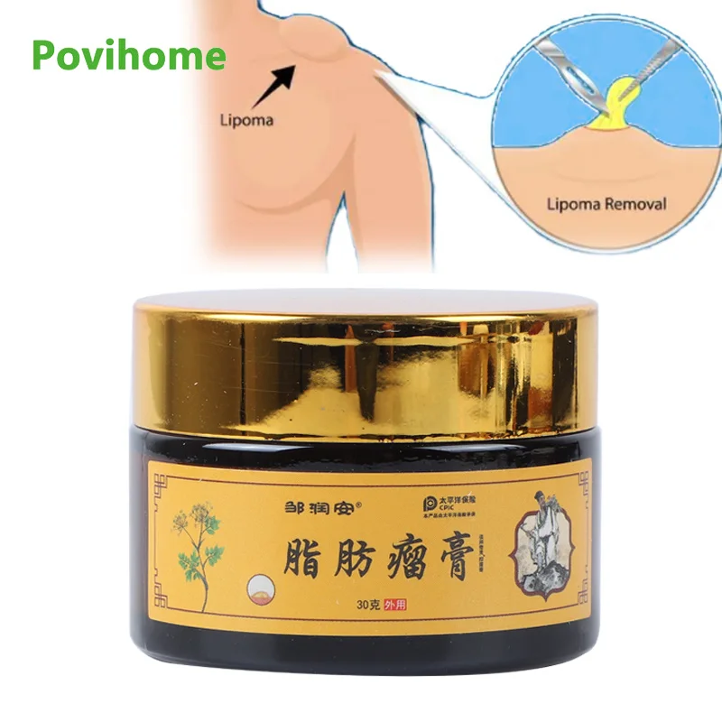 30g Lipoma Remover Medicines Cream Fat Mass Treatment Ointment To Subcutaneous Lump Fibroma Cellulite Skin Swelling Plaster