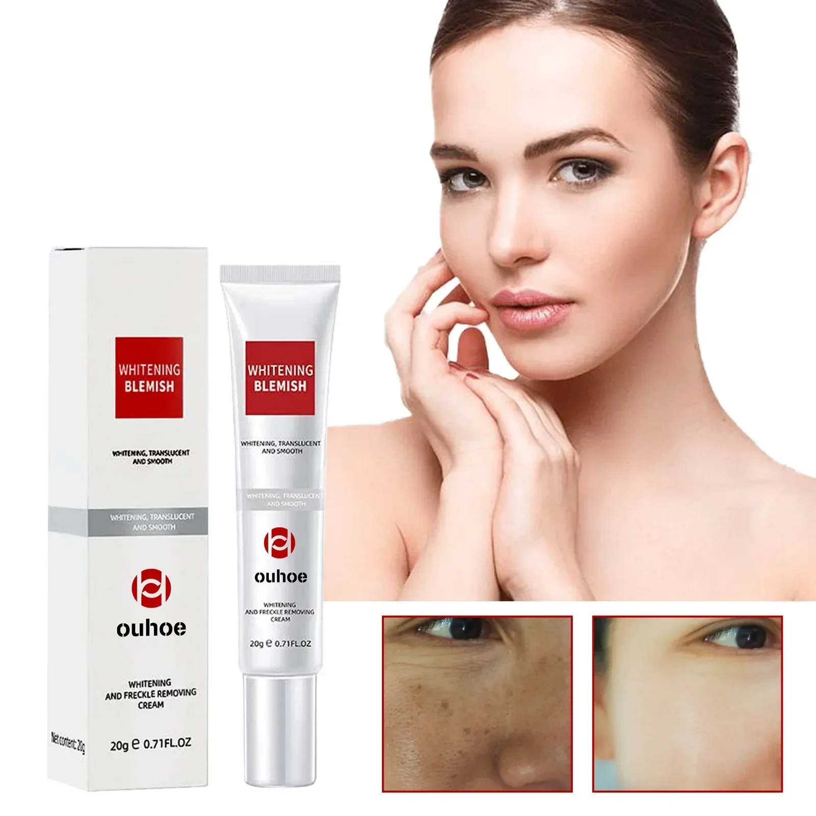 

Dark Spot Skin Whitening Fade Cream Lightening Blemish Removal Reduces Age Spots Freckles Face Cream anti aging face cream