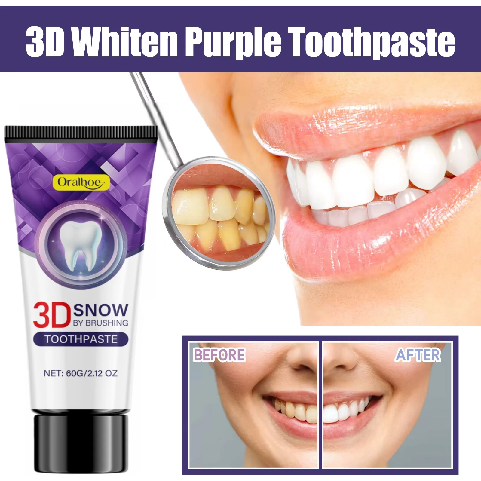 

Фиолетовая отбеливающая зубная паста: удаление пятен, освежение дыхания, глубокое очищение, бережный уход за деснами, полирующий порошок для зубов