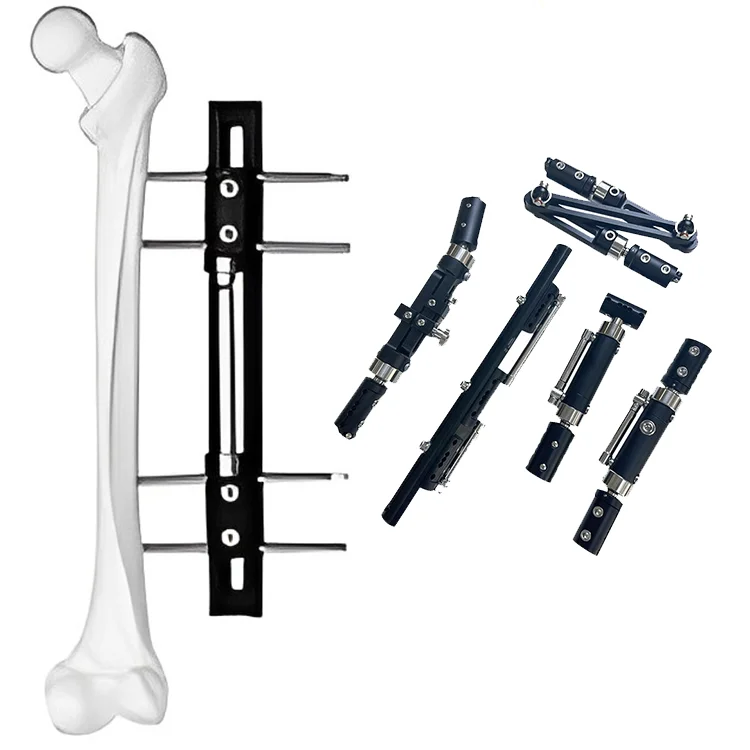 Fabricación china, fijación externa ortopédica, reconstrucción quirúrgica, fijación externa, fijador externo Axial dinámico