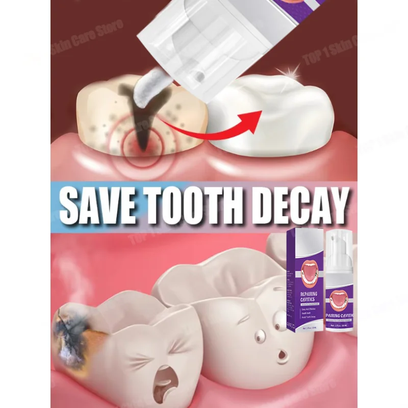 

Tooth decay Repair Repair all cavities, protect teeth remove plaque stains Tooth decay repair teeth whitening Dental