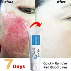 Facial Redness Repair Cream Improve Sensitive Skin Dryness Moisturizer Hydrating Sooth Lotion Removal Rosacea Korean Cosmetics