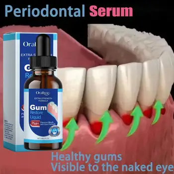 Gel reparador de encías dañadas, suero para el cuidado, alivio de encías doloridas, alergias, limpieza profunda, manchas dentales, suero para sarro, pasta de dientes para caries. 10 best sales Chiclete - №8