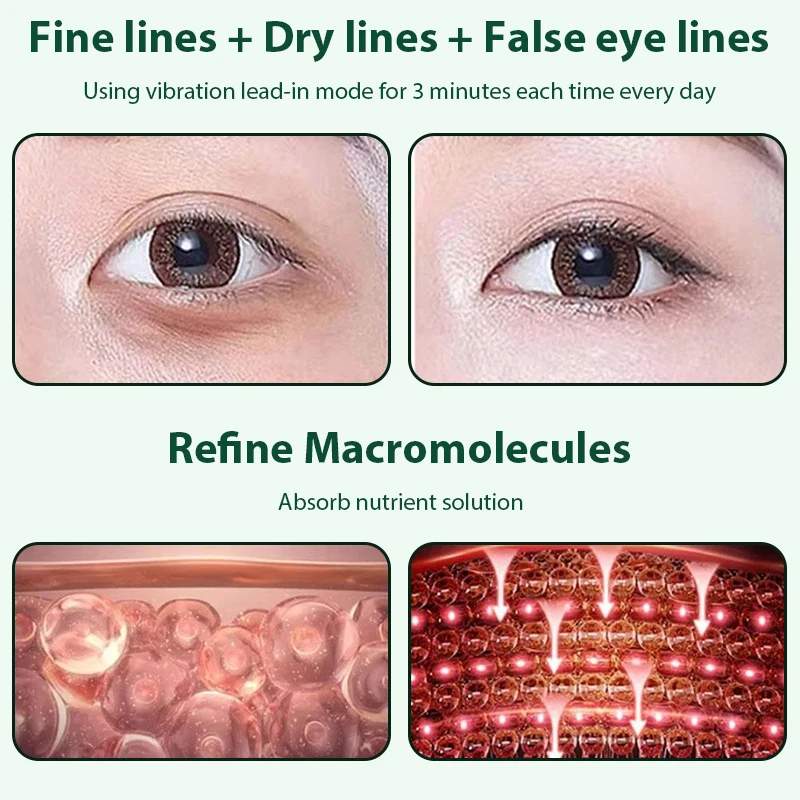EMS-terapia de luz roja y azul, masajeador ocular antienvejecimiento, alivio de la fatiga ocular, relajación, alivia las ojeras, compresa fría y caliente, cuidado de los ojos
