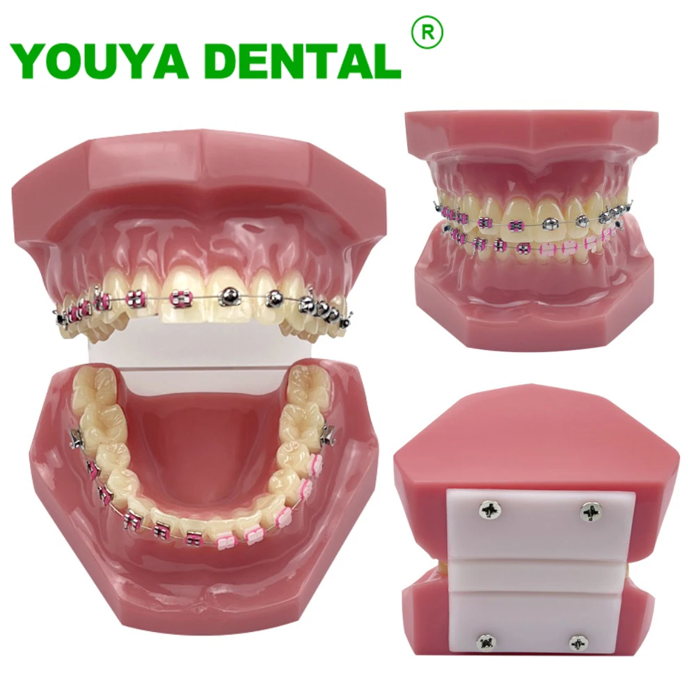 

Orthodontic Model With Half Metal Half Ceramic Teeth Model Dental Typodont Ball Shaped Self Ligating Metal Bracket Demonstration