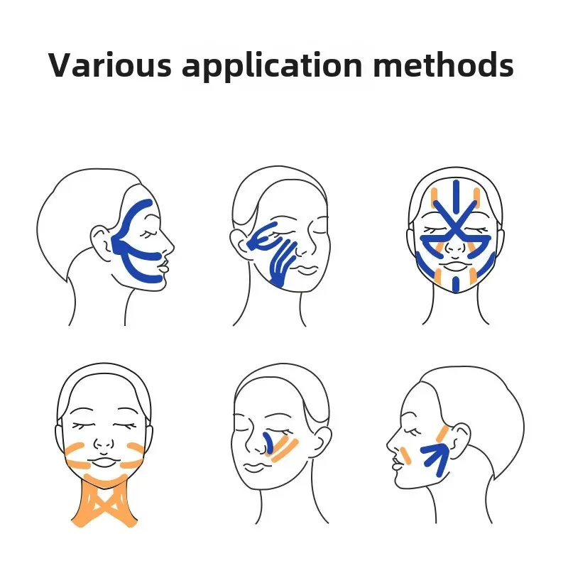 Medical facial muscle patch with lifting pattern and nasolabial folds, using facial specific adhesive tape and sports tape