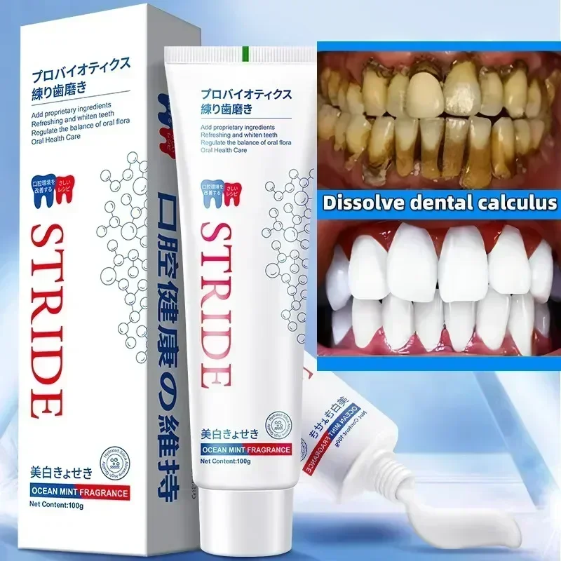 Dental Calculus Remover Toothpaste Bad Breath Removal Brightening Whitening Teeth Preventing Periodontitis Dental Cleansing Care