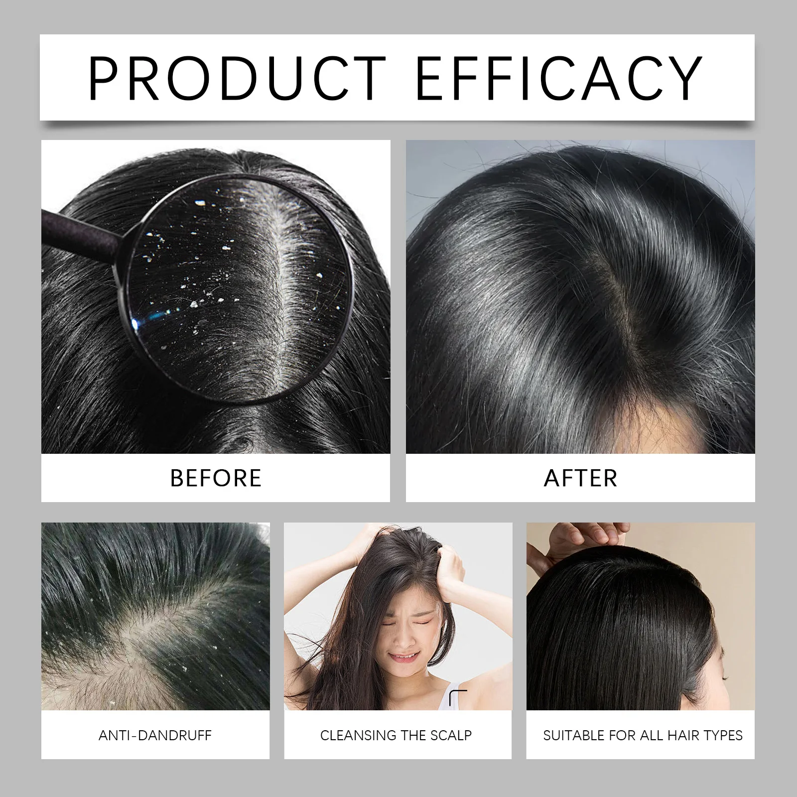 شامبو تنظيف فروة الرأس للشعر، شامبو لطيف للتحكم في الزيوت وإزالة القشرة، شامبو منعش لتنعيم منتجات العناية بالشعر أكثر نعومة #5