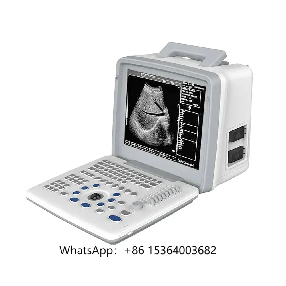 

LTUB62V Full Digital Vet Ultrasound Diagnostic System Veterinary Portable Ultrasound Machine