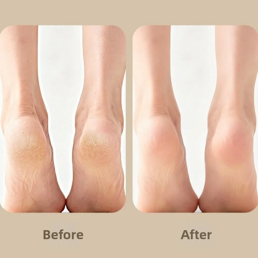 3-in-1-Fußbürstenwäscher, ergonomisch, mit Griff, abgestorbene Haut, Hornhautentferner, Handheld-Peeling, Fußreibe, Pediküre-Werkzeug