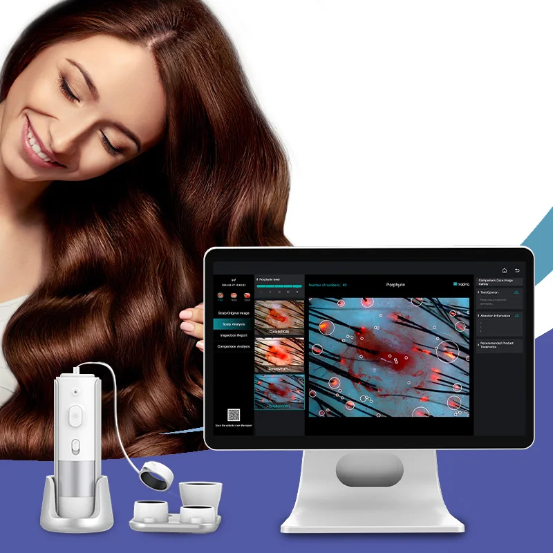 AI Intelligent Hair Tester, Skin Analyzer, Scalp Care, Cloud Data Storage, Hair Analysis Machine, Beauty Health Device