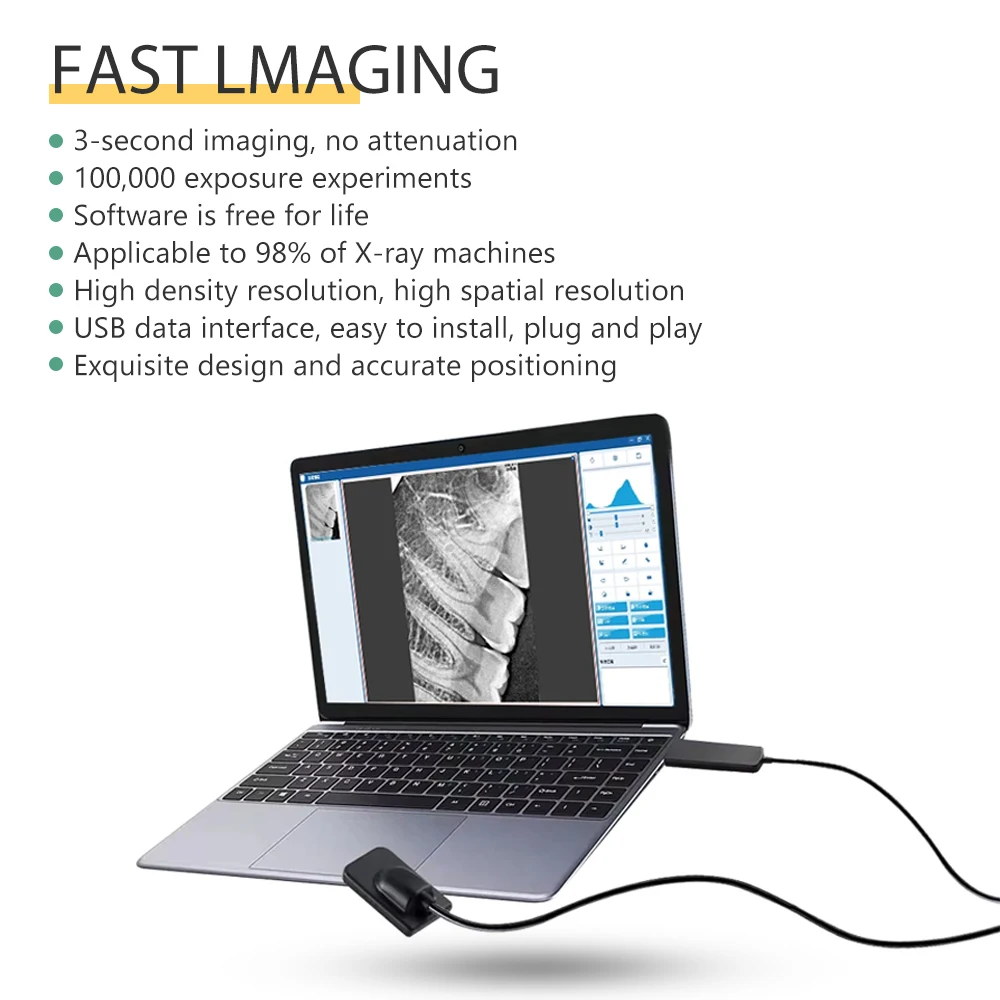 EYY Dental Sensor RX Digital Intraoral Imaging System HD Image Radiovisografo DynImage X-ray Oral Sensor Dental Image Equipment