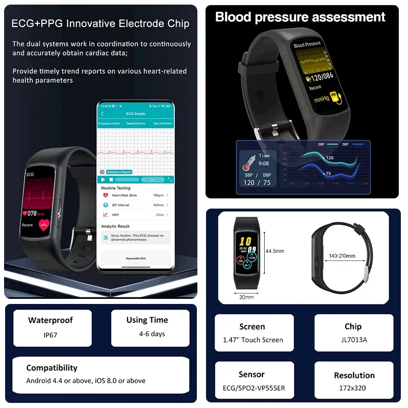 Montre intelligente de qualité médicale pour femme, AMOLED, sucre dans le sang, graisse, fréquence cardiaque, détecteur d'acide urique, appel BT, montre intelligente originale, santé, nouveau, 2024