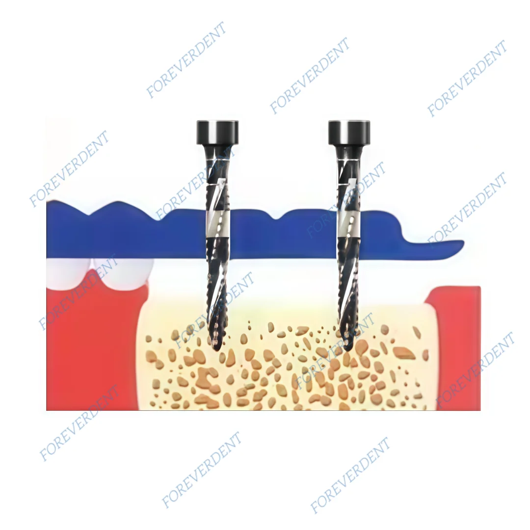 Dia2.3MM Dental Cross Cutter Bone Side Cut Silver Drill Implant Graft Bit Dentist Clinic Lab Black φ2.3mm