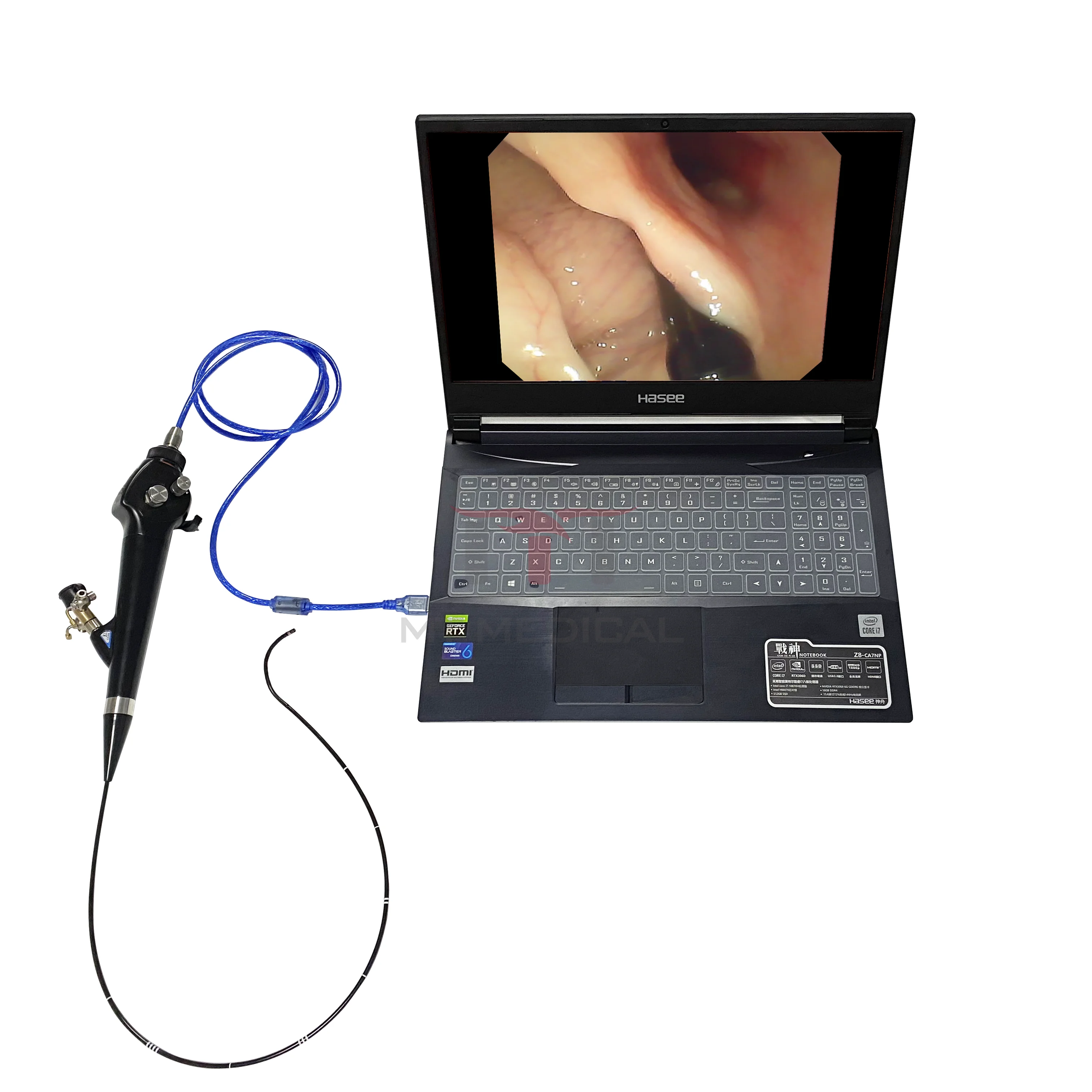 MT MEDICAL Pet Surgery Machine Vet Laryngoscope Animal Disposable Video Laryngoscope Device Price
