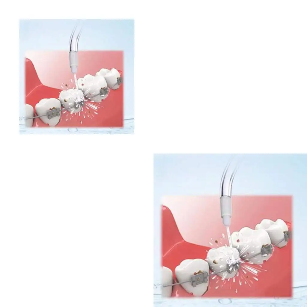 Orthodontic Tips for Waterpik Water Flossers Irrigators Random Color