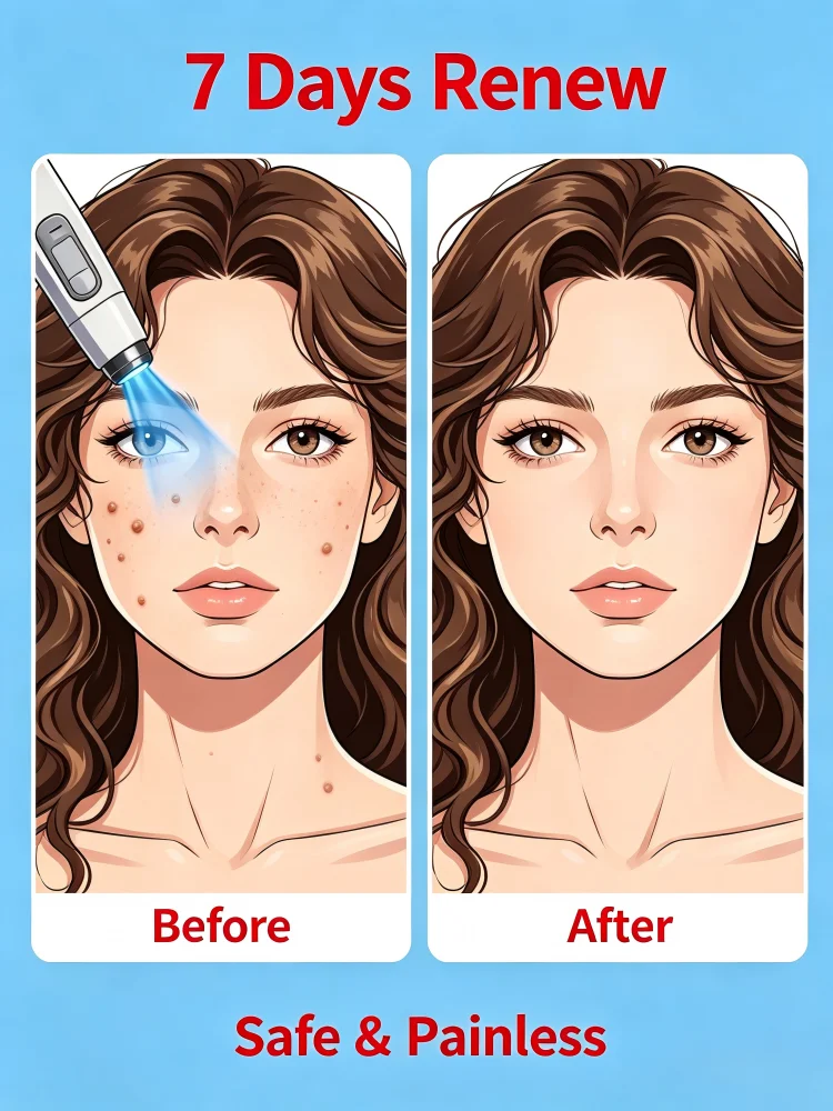 2026 New Handheld Skin Smoothing Pen ，Optimize Uneven Skin Surface，For All Ages Daily Maintenance