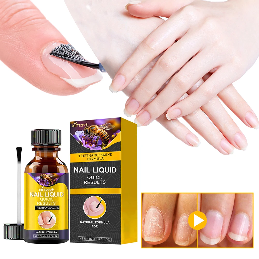 

Bee-Venom Nail Treatments Serum Powerful Nail Growth Repair Serum For Thin Nails For Nail Strengthener