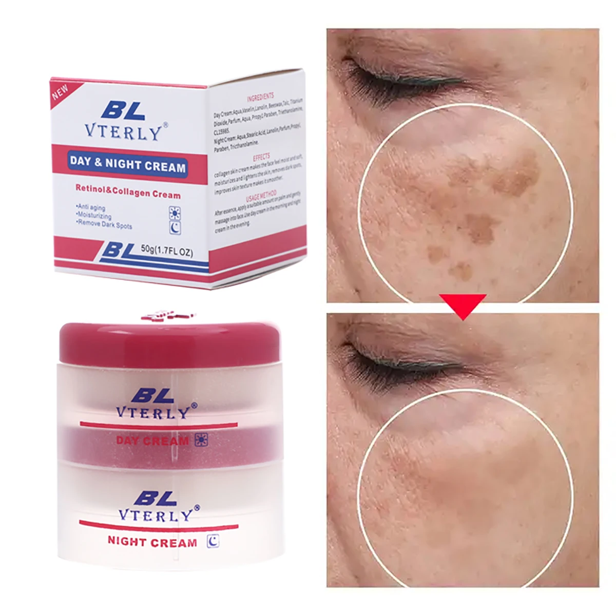 

BL Vterly Day And Night Freckle Cream Dark Spot Removal Lightening Whitening Brightening Face Cream