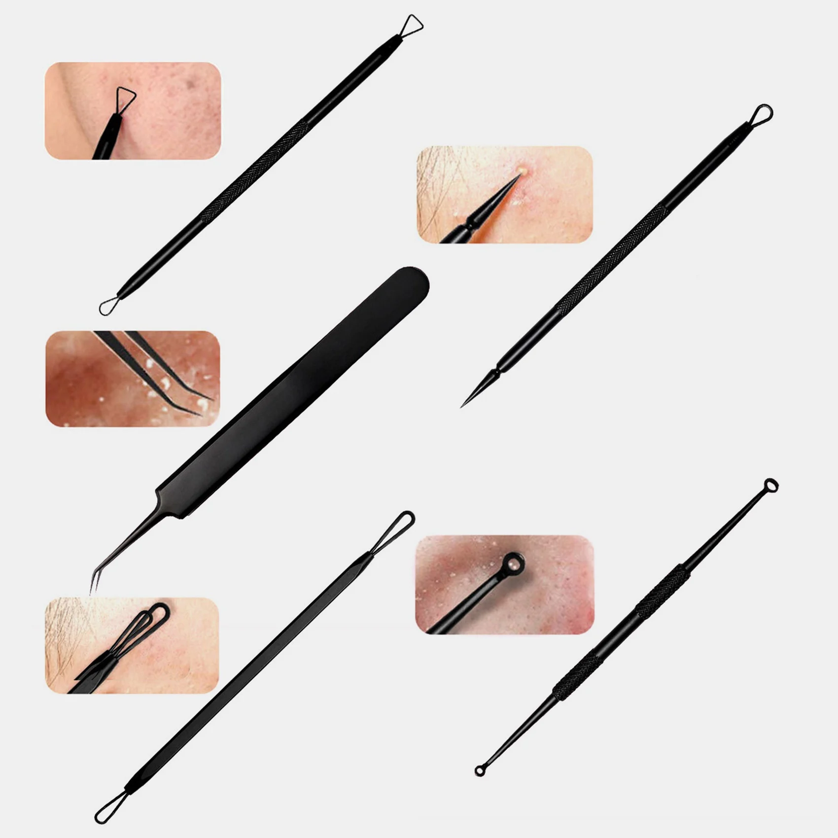 M14K-Blackhead Remover Pimple Popper Tool Kit 22 Pcs, Pimple Extractor Tool, Acne Kit For Blackhead