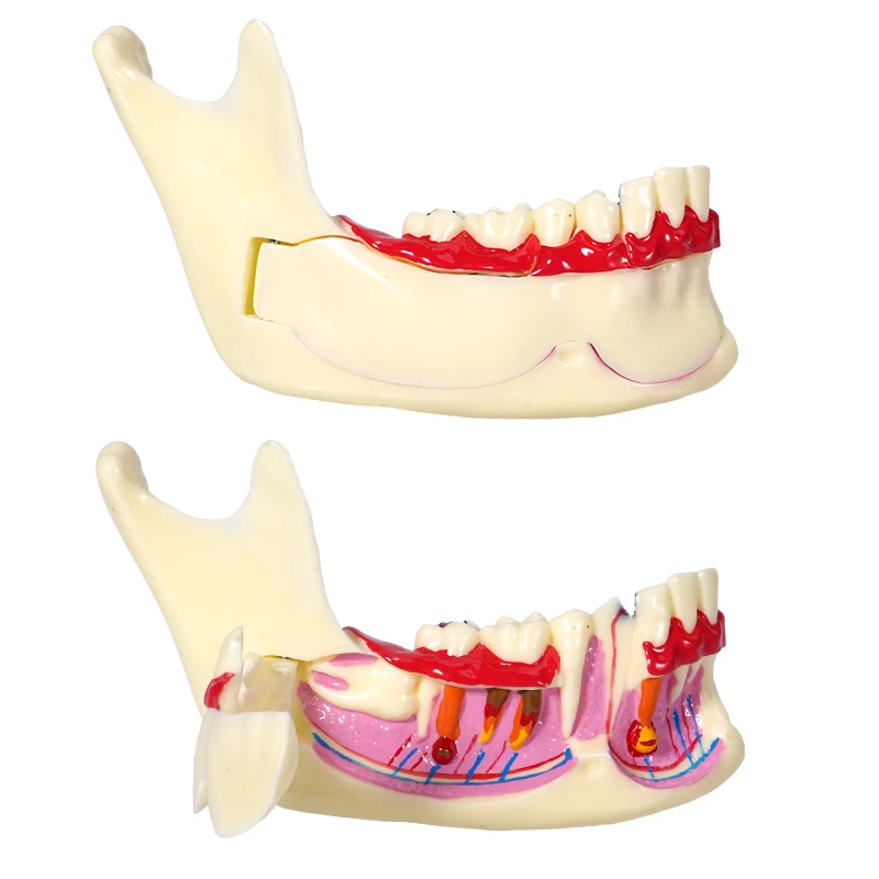 1 Stück Zahnmedizinisches Unterkiefer-Dekompositionsmodell mit Zahnfleischseitenöffnung zur Demonstration und Anatomie-Unterricht