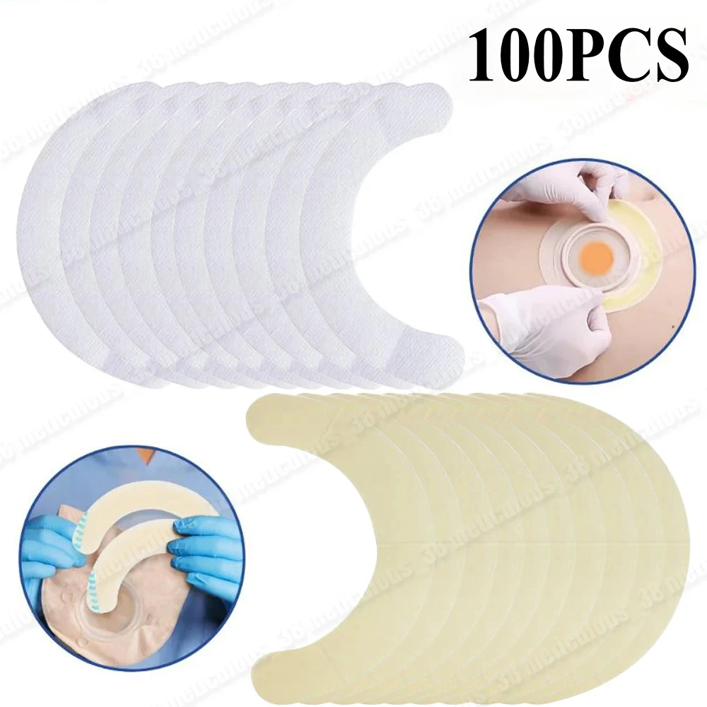 

100Pcs Elastic Ostomy Barrier Strips Hydrocolloid Waterproof Leak Skin Adhesive Ostomy Barrier Tape for Colostomy Bag
