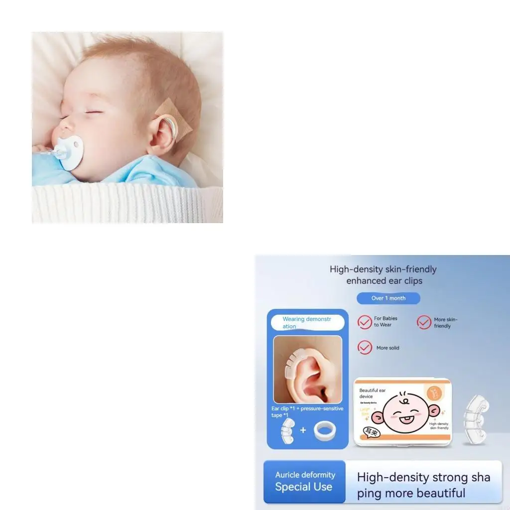 Ergonomic Infant Ear Reshaper Breathable Silicone Device For Delicate Ears