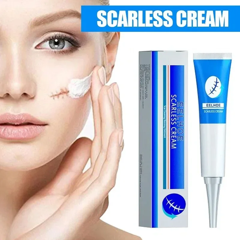 Scar Repair Cream Acne Scar Stretch Mark Remover For Burn Scars Old Postoperative Removal Skin Smoothing