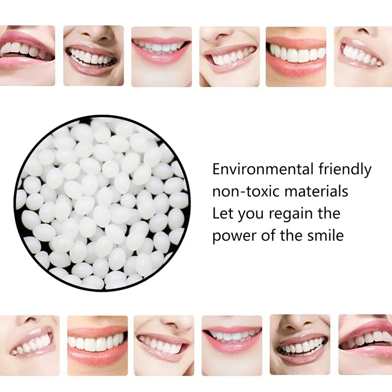 Denture Repair Kit, Thermal Forming False Teeth Repair Beads, Shapeable Dental Adhesive ,Fill Fix The Missing And Broken Tooth