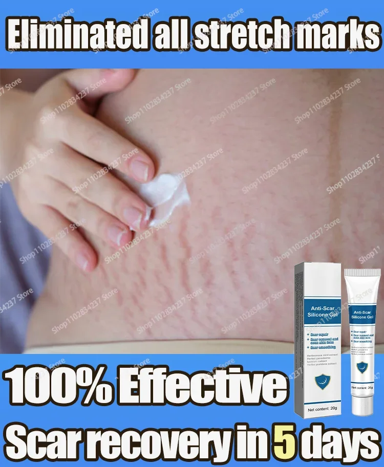 Repair Stretch Marks Scars Fade Them For Pregnant Women After Childbirth