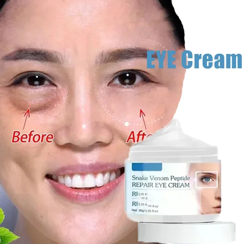 Instantly Eye Cream Eye Bags Removal Against Puffiness Long Lasting Turns Wrinkles Anti-wrinkle Eyes Care Serum Cream