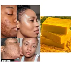 Turmeric Lemon Kojic soap, Glowing skin best soap Ever